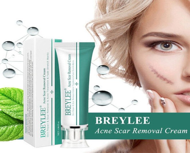 Breylee Acne Scar Removal Cream Price in Pakistan
